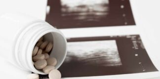 Spilled pills beside medical imaging prints