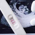 Mail-Order Abortion Showdown Escalates Pregnancy test with two lines on an ultrasound print